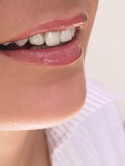 Cosmetic Dentistry Bristol