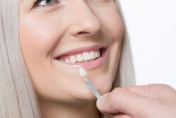 Cosmetic Teeth Whitening Bristol
