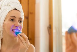 Do Teeth Whitening Lights Work?
