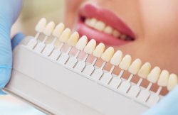 Is Teeth Whitening Dangerous