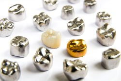 Will Teeth Whitening Damage Crowns?