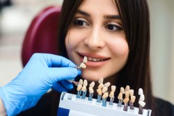Replacement Teeth Bristol