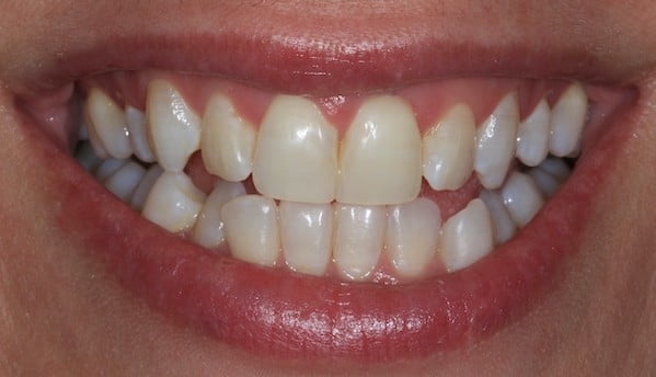 Cosmetic Dentistry - Bristol Dental Practice