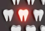 Telltale Signs You Need A Root Canal