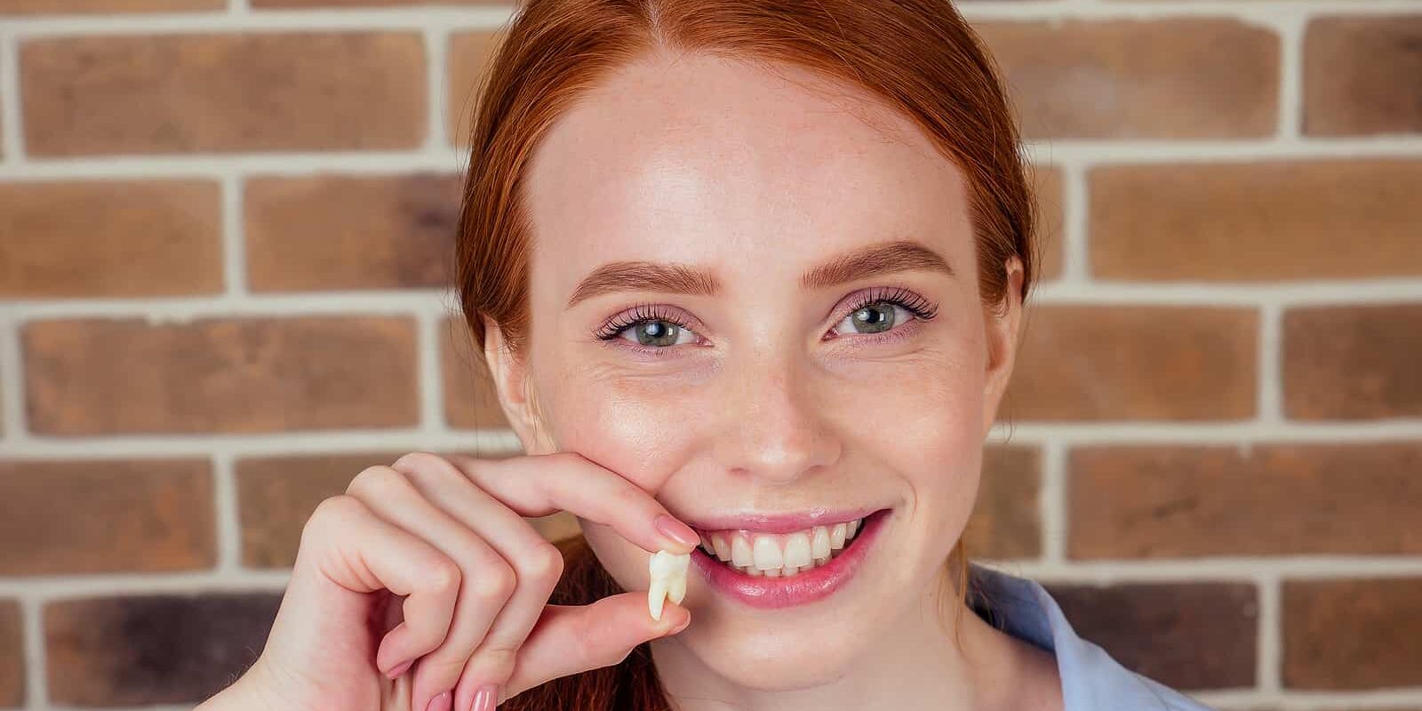Redhaired Ginger Female With Snow-white Smile Holding White Wisd Wisdom Tooth Removal in Bristol