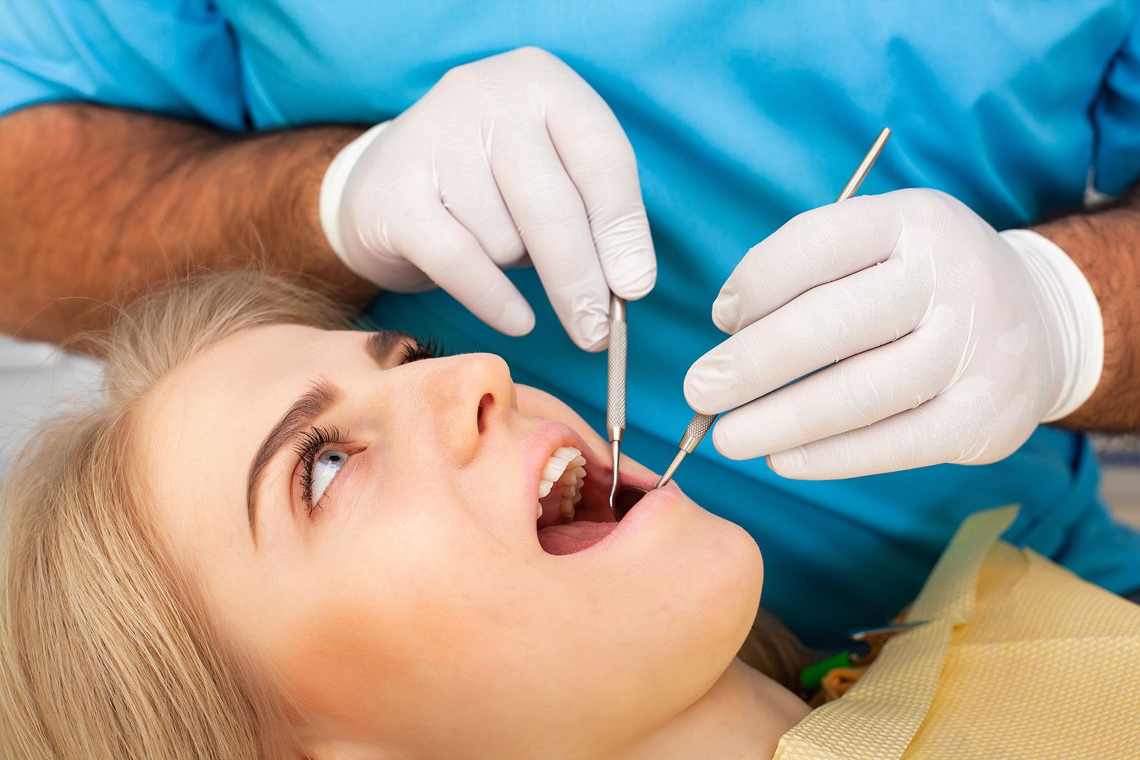 What to Expect During Wisdom Teeth Removal at The Bristol Dental Practice